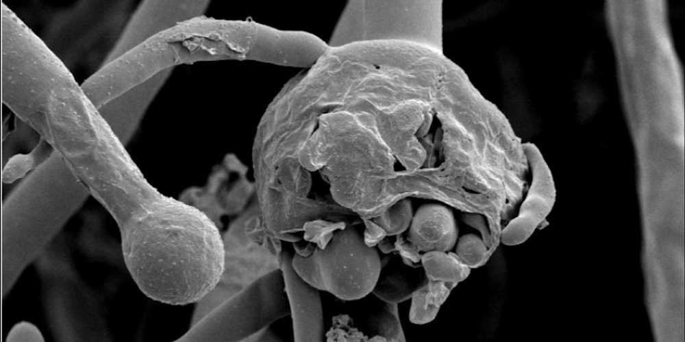 
            Electron micrograph showing sporangia of Mucorales fungi that causes Mucormycosis.